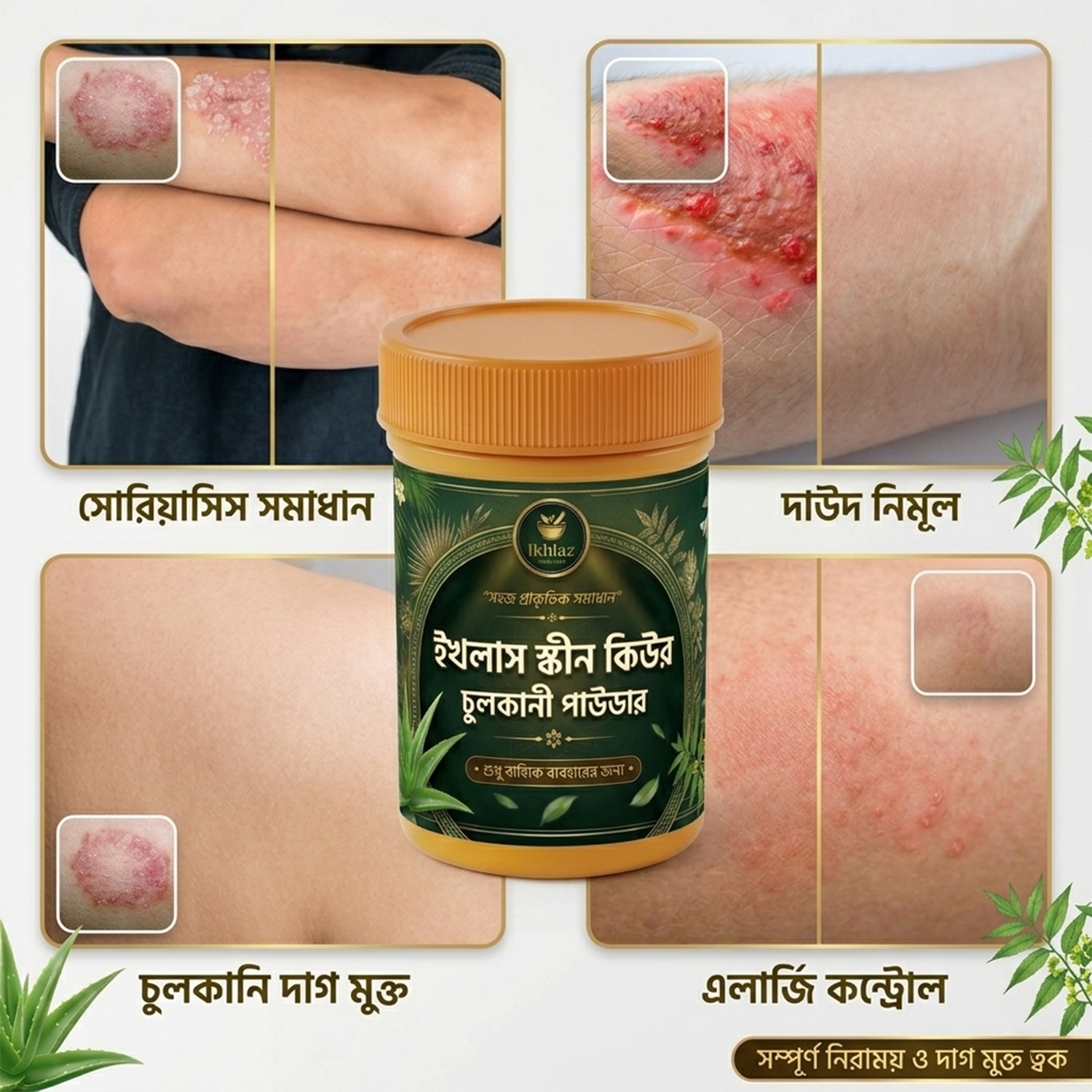 ইখলাস স্কীন কিউর - চুলকানী পাউডার